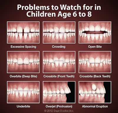 Phase One Orthodontics and Your Child’s Teeth